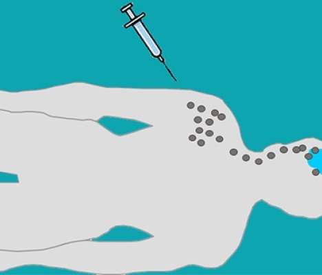 vaccin cancer du cerveau