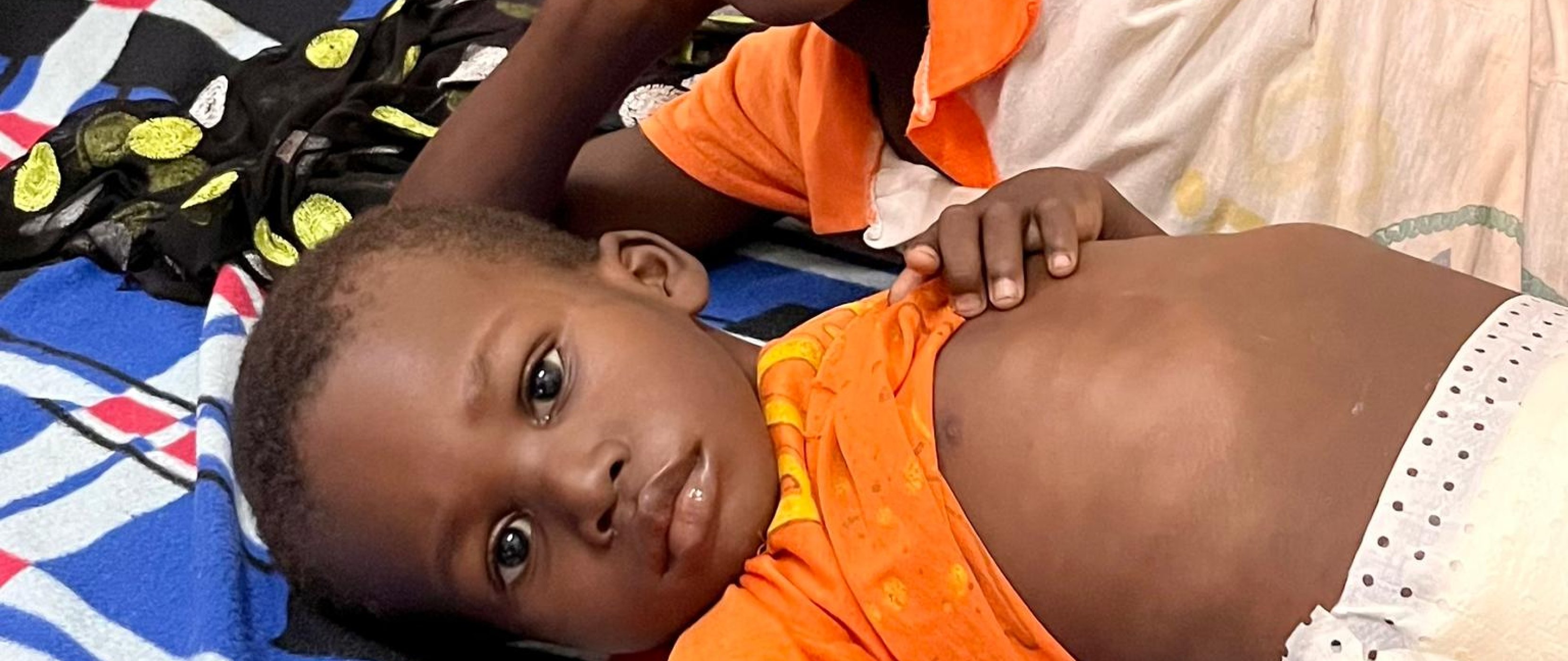 Du Burkina Faso au monde : bâtir un modèle durable de chirurgie pédiatrique